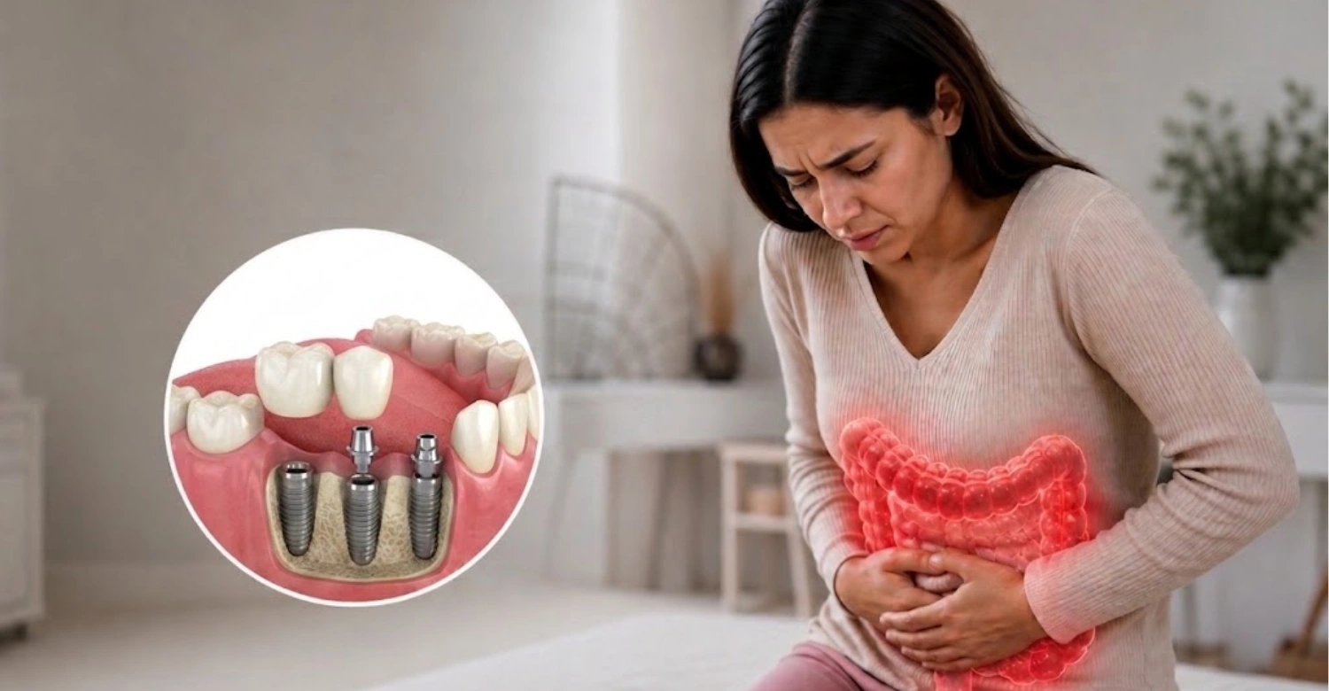 Ulcerative colitis and dental implants2